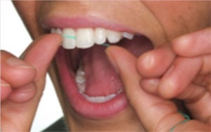 When the floss reaches the gumline, curve it into a “C” shape against one tooth