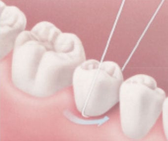 Rub the floss from side to side along the underside of the pontic