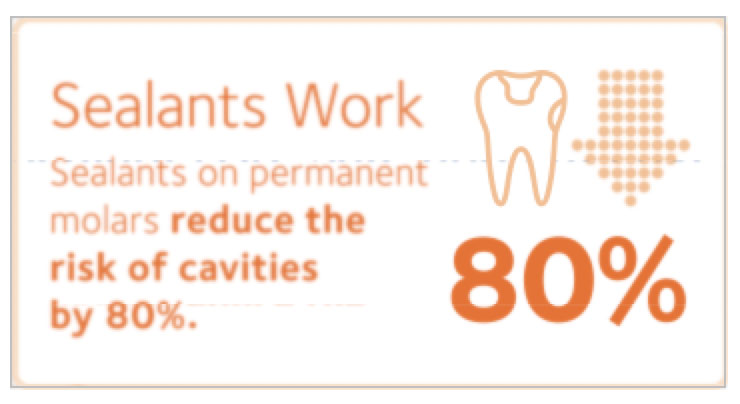 Sealants on permanent molars reduce the risk of cavities by 80%