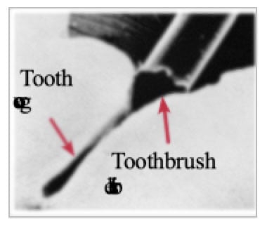 Magnified image of toothbrush bristle
