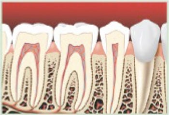 Healthy teeth and roots without signs of decay
